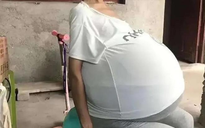 原来他们早已离婚,如今一个在北京当会长,一个发福明显商演谋生